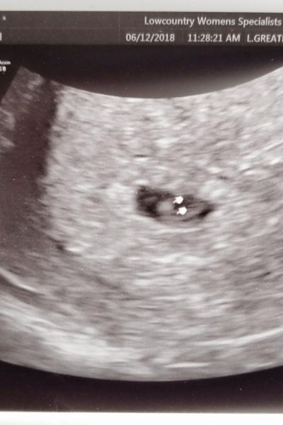 Dear Little Red: Your First Picture